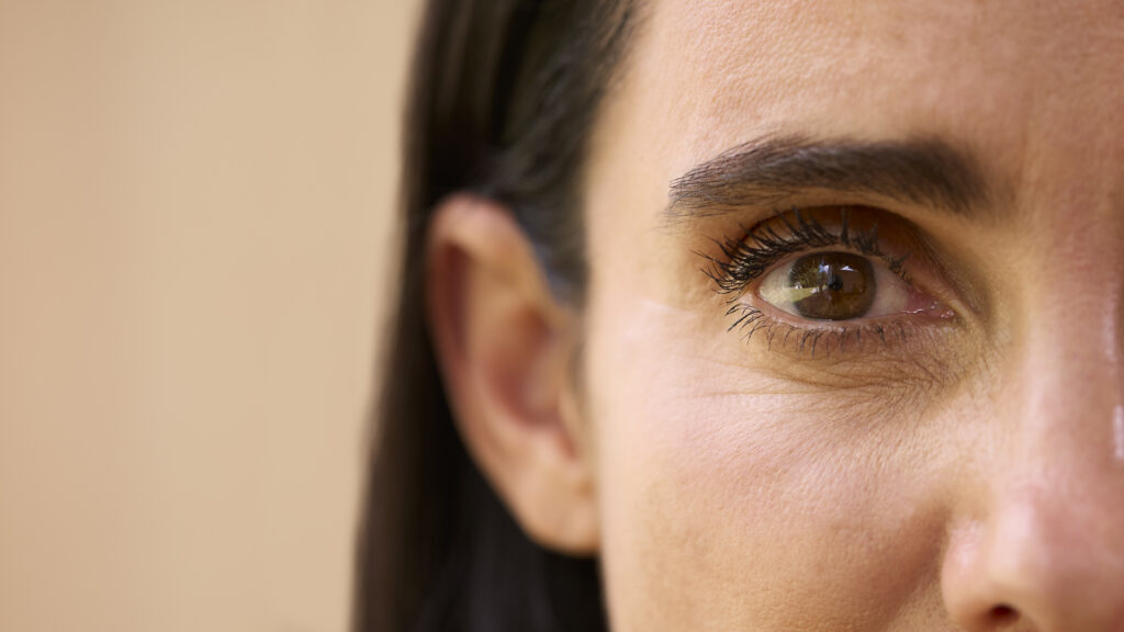 Dra. Carla Villena | Blefaroplastia, cantopexia o ácido hialurónico: ¿qué tratamiento necesita tu mirada?